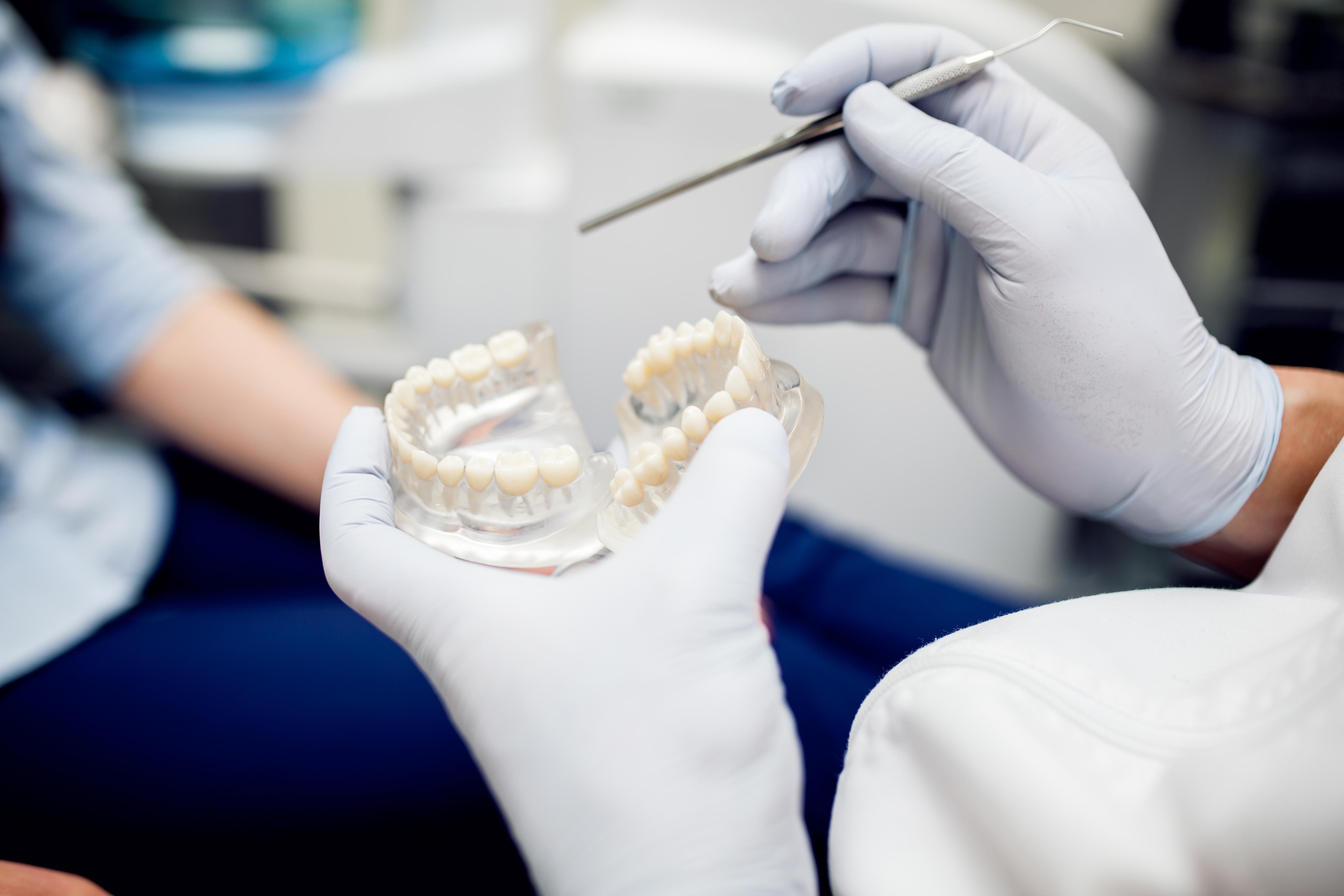 Carillas de Composite o Porcelana: ¿Qué opción es mejor para transformar su sonrisa?
